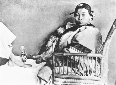 Chinese Woman Showing Her Uncovered Bound Foot Near an European Foot by John Thomson